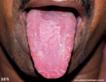 tongue geographic