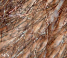 monilethrix