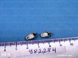 keratoacanthoma pendulum