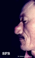cyst epidermoid