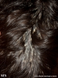 pityriasis amiantacea