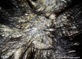 pityriasis amiantacea