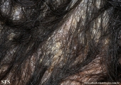 pityriasis amiantacea