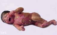 collodin baby