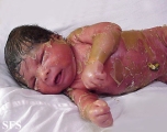 collodin baby