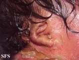 collodin baby