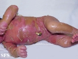 collodin baby