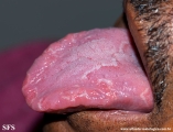 tongue geographic