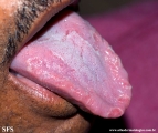 tongue geographic