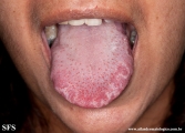 tongue geographic