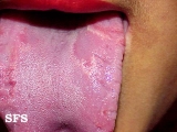 tongue geographic