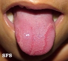tongue geographic