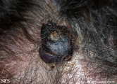 angiosarcoma