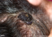 angiosarcoma
