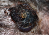 angiosarcoma