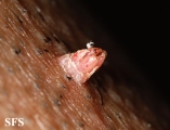 warts filiformis