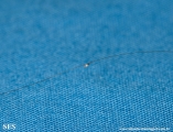 pediculosis capitis