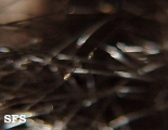 pediculosis capitis