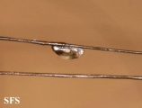 pediculosis capitis