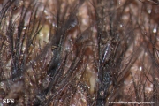 pediculosis capitis