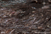pediculosis capitis