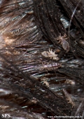 pediculosis capitis