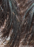 pediculosis capitis