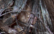 pediculosis capitis