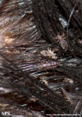 pediculosis capitis