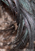 pediculosis capitis