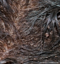 pediculosis capitis