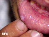 mucocele