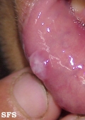 mucocele