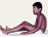 thrombocytopenic purpura idiopatic