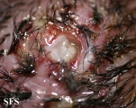myiasis