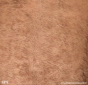 papilomatosis confluentes and reticulate