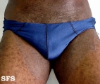 tinea cruris