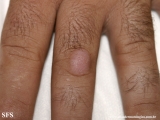 knuckle pads