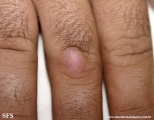 knuckle pads