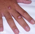 knuckle pads