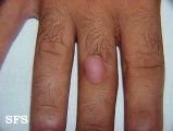 knuckle pads