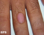 knuckle pads
