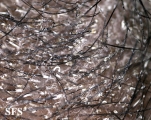 tinea capitis