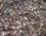 tinea capitis