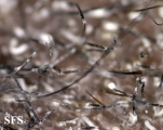 tinea capitis