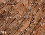 tinea capitis