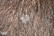 tinea capitis