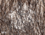 tinea capitis
