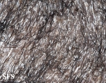 tinea capitis