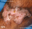 chromomycosis